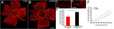 Myriocin Effect on Tvrm4 Retina, an Autosomal Dominant Pattern of Retinitis Pigmentosa